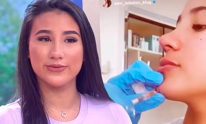 Samahara Lobatón se hizo armonización facial y ahora así luce su rostro