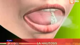 	<p>Qué es el Halitosis</p>