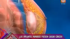 ¿Los implantes mamarios pueden causar cáncer?