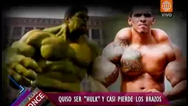 	<p>Hombre quiso ser Hulk, pero no imaginó las graves consecuencias</p>