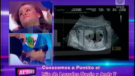 	<p>Lourdes Sacín y Andy V escucharon latidos de su bebé en vivo</p>