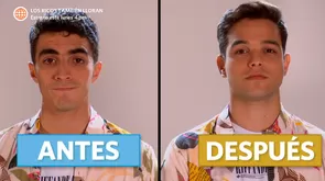 Jimmy quedó en shock tras ver comercial televisivo de antes y después de operación estética