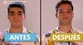 Jimmy quedó en shock tras ver comercial televisivo de antes y después de operación estética