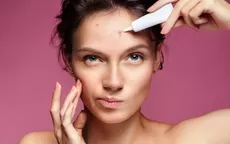 ¿Qué maquillaje usar si tengo acné? - Noticias de cuidado-piel