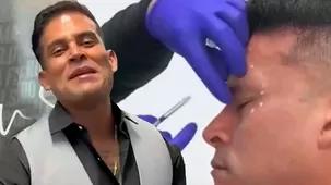 Christian Domínguez se sometió a retoque estético previo a su boda con Karla Tarazona.  Fuente: América Hoy 