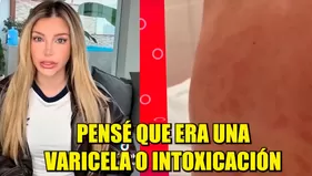 Flavia Laos preocupó al contar enfermedad que sufre