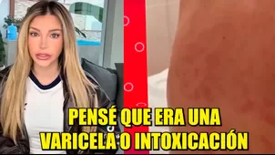 Flavia Laos preocupó al contar enfermedad que sufre