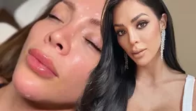 Sheyla Rojas enfureció por críticas a su nuevo retoquito