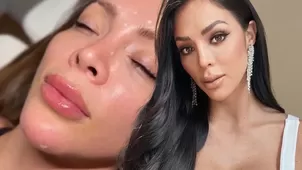 Sheyla Rojas enfureció por críticas a su nuevo retoquito