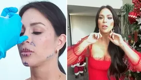 Sheyla Rojas se hace nuevo arreglo en el rostro y revela que no puede hablar bien: ¿Qué le pasó?