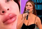 Sheyla Rojas sobre parálisis facial: "Me quedé traumada, ya no quiero operaciones"