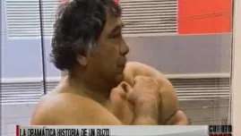 	<p>Buzo padece daño a su salud. Video: América TV</p>