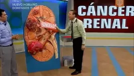 	<p>C&aacute;ncer renal: 5 s&iacute;ntomas de esta silenciosa enfermedad.</p>