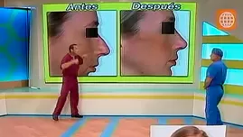 Conoce las 4 cirugías más comunes en el rostro