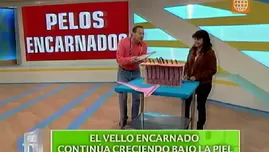 	<p>Depilaci&oacute;n: soluci&oacute;n para sacar los pelos encarnados en la piel.</p>