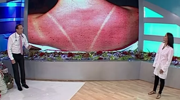 Doctor TV: Los protectores del verano para evitar el cáncer de piel