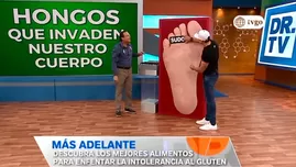 	<p>Dr.TV: Conozca las causas de los molestos hongos</p>