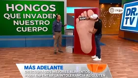 Dr.TV: Conozca las causas de los molestos hongos 