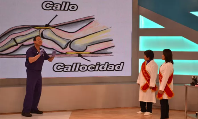 DRTV: Sepa diferenciar un callo de una callosidad y su tratamiento