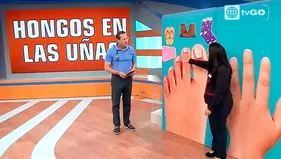 Hongos en las uñas: cuidado con el contagio por estos objetos