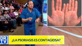 	<p>Lo que debes saber sobre la psoriasis</p>