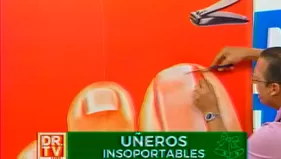 Uñeros: ¿Por qué aparecen las uñas encarnadas?