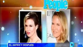 Conoce el antes y después de las actrices que se sometieron a cirugías 