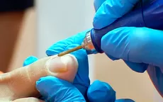 Hongos en las uñas: Tratamiento seguro y efectivo para eliminarlos - Noticias de cuidado-piel