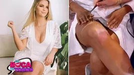 	<p>Brunella Horna reveló su secreto para las celulitis en las piernas.</p>