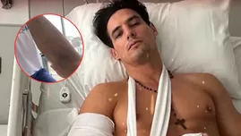 Facundo González mostró cicatriz de su operación  | Fuente: Instagram Facundo González 