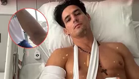 Facundo González impactó al mostrar cicatriz de su operación