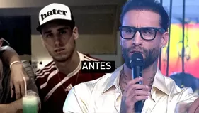 Jota Benz y su reacción al ver su antes y después en EEG