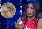 Karen Dejo sorprendió al mostrar cicatriz de su lesión en el dedo
