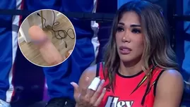 Karen Dejo enseñó cicatriz de lesión en su dedo | Fuente: Instagram Karen Dejo