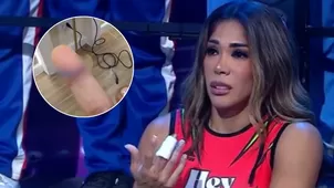 Karen Dejo sorprendió al mostrar cicatriz de su lesión en el dedo