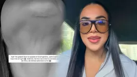 Onelia Molina expuso en redes fuerte golpe que sufrió en EEG