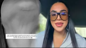 Onelia Molina expuso en redes fuerte golpe que sufrió en EEG
