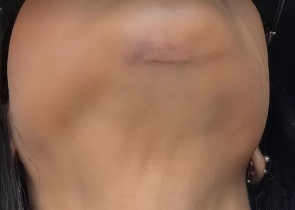 Golpe de Onelia Molina en EGG | Fuente: Instagram oneliamolina_