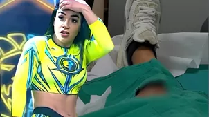Onelia Molina impactó al mostrar la herida de su fuerte lesión