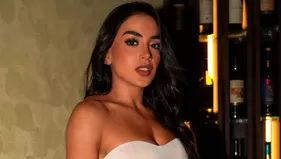 Onelia Molina sorprendió al lucir retoque estético en el rostro