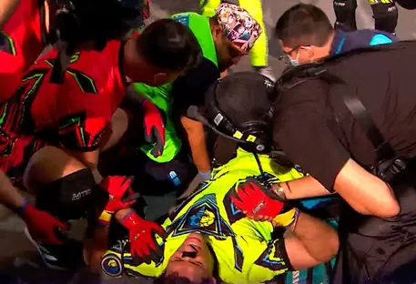Patricio Parodi sufrió terrible lesión durante la competencia 