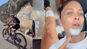 Anna Carina Copello sufrió aparatoso accidente: Fue una pesadilla