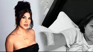 Brunella Torpoco preocupó en redes por delicado estado de salud