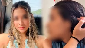 Camila Domínguez mostró como quedó su nariz tras retoque estético