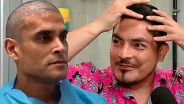 Erick Elera opinó sobre implante de pelo de Christian Domínguez. | Fuente: América Televisión