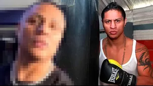 Jonathan Maicelo luce irreconocible tras operarse la nariz