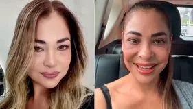 Melanie lució retoque estético en medio de polémica con Domínguez
