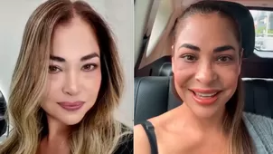 Melanie lució retoque estético en medio de polémica con Domínguez