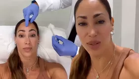 Melissa Loza sorprendió con nuevo retoquito en su rostro