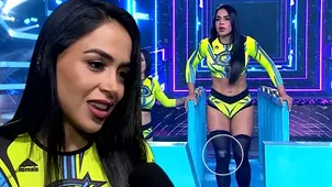 Onelia Molina contó cómo se accidentó la rodilla: "Me duele"